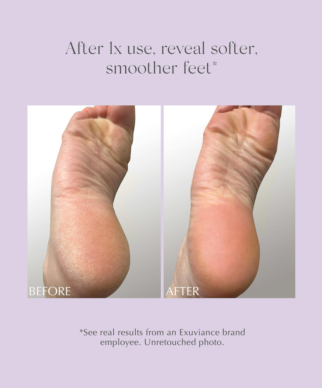 Exfoliating & Conditioning Foot Balm 50GR