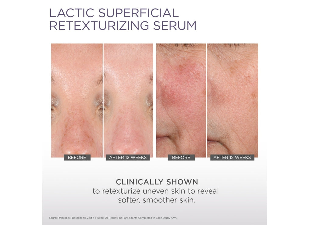 Micro-Peel Lactic Superficial Retexturizing Serum 30ML