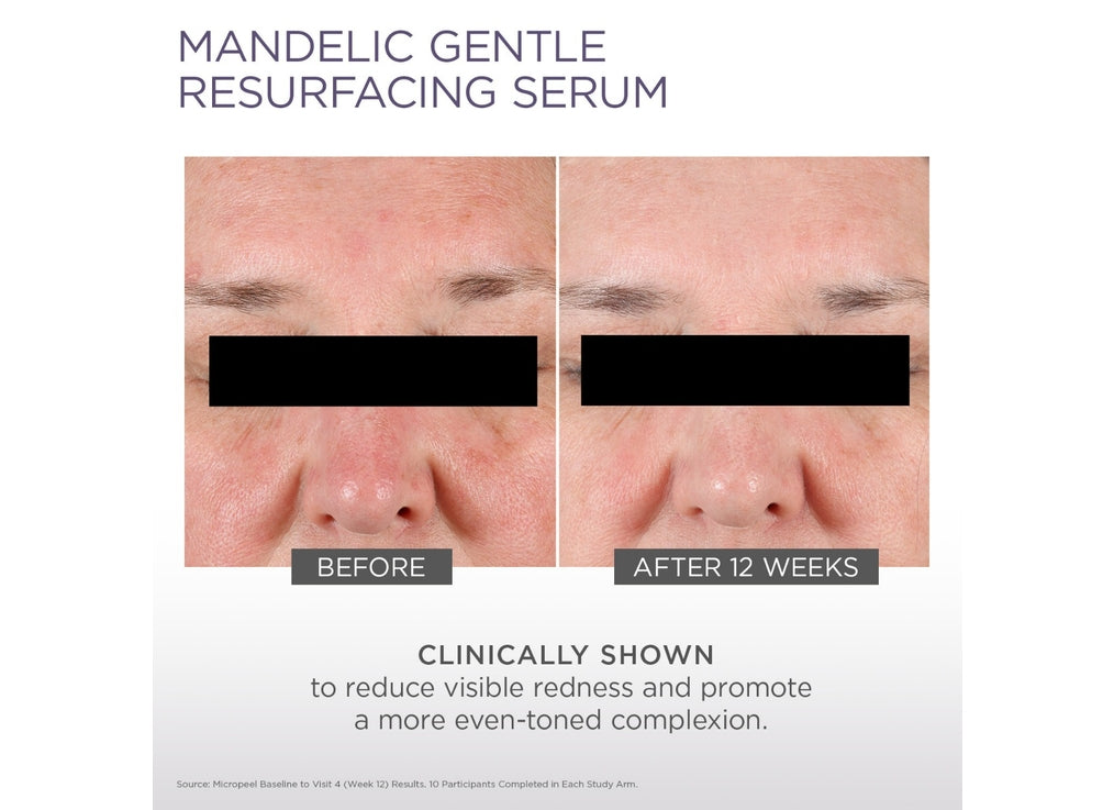 Micro-Peel Mandelic Gentle Resurfacing Serum 30ML