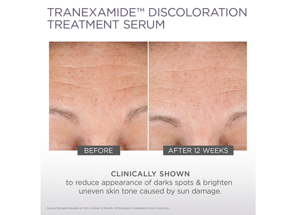 Micro-Peel TranEXamide Discoloration Treatment Serum 30ML