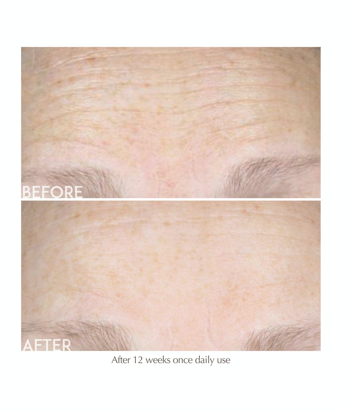 Rapid De-Crease