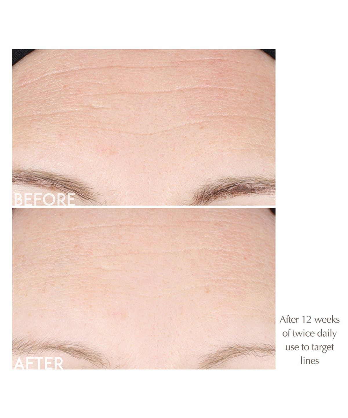 Wrinkle Smooth Topical Peptide 5GR