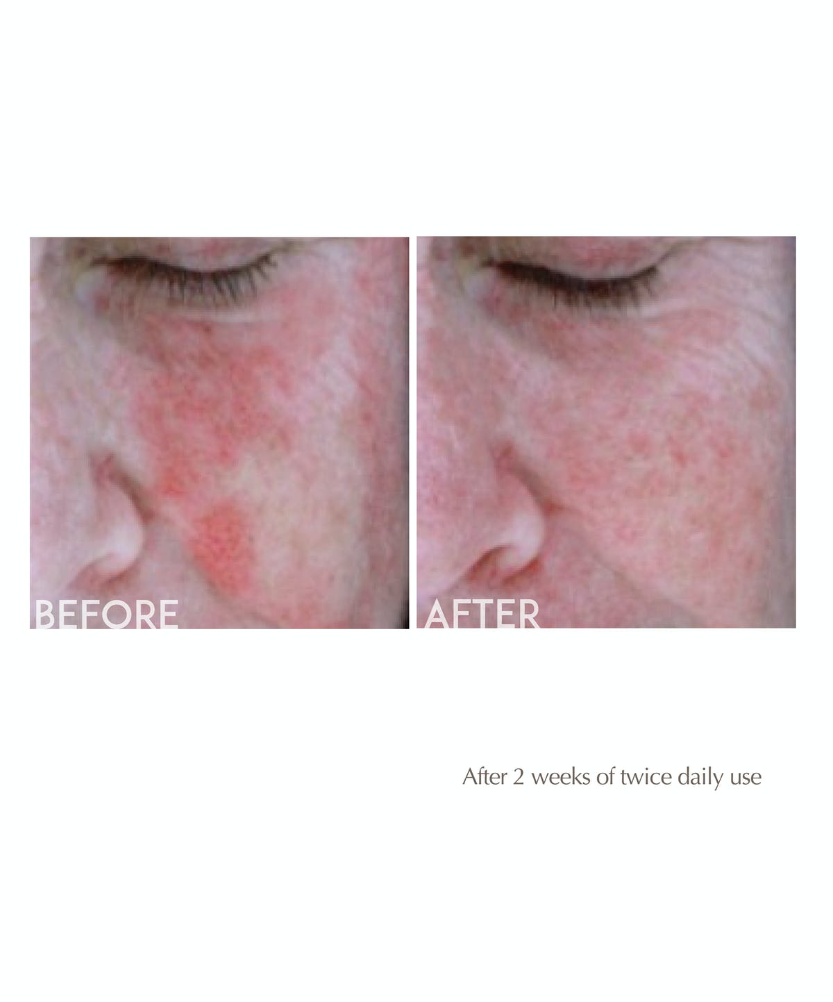 ANTIREDNESS CALMING SERUM-29G