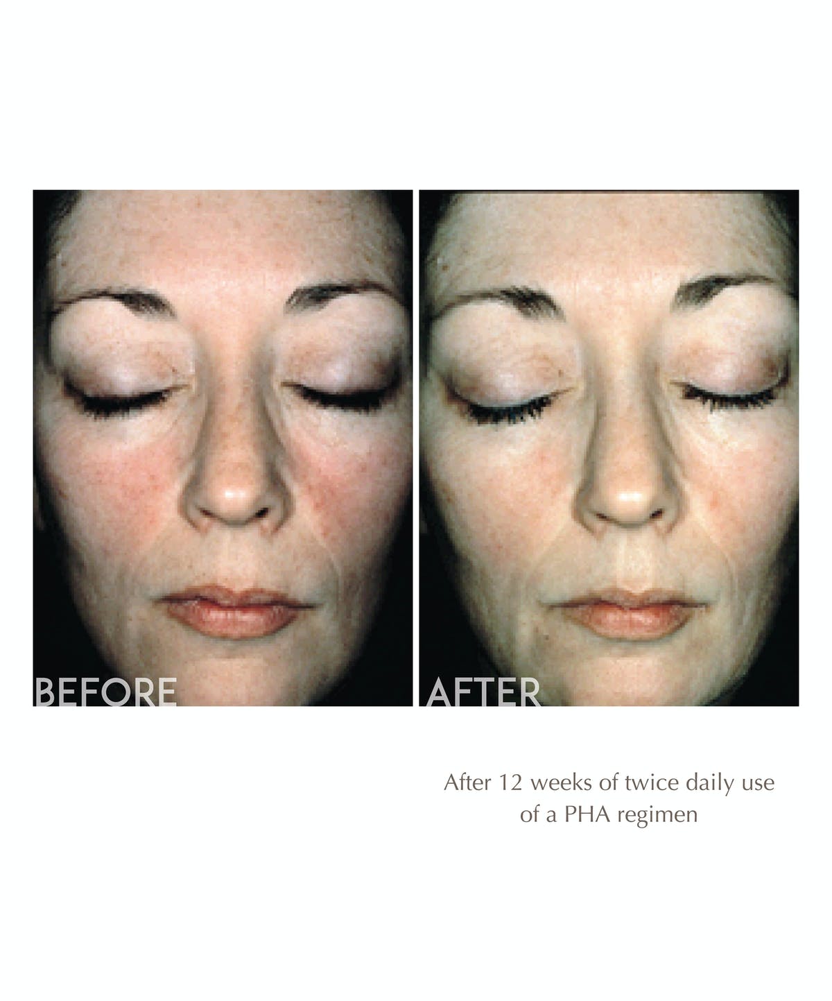 Overnight Transformation Complex 50GR