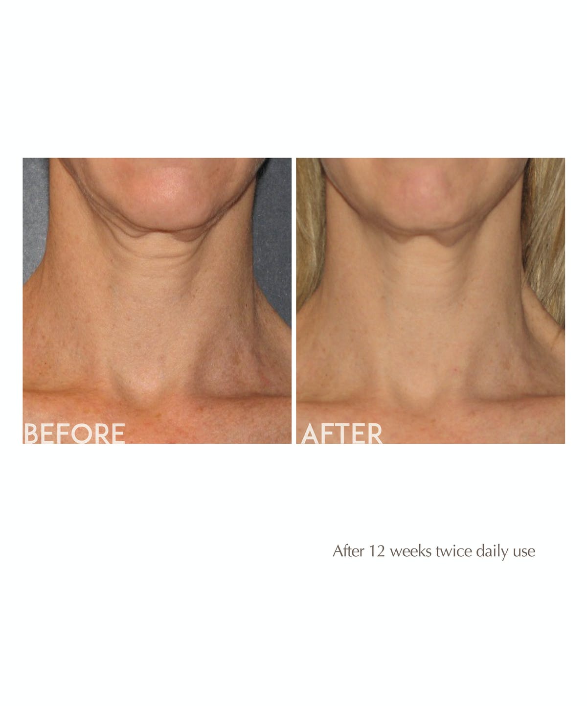 AGE REVERSE Toning Neck Cream 125GR