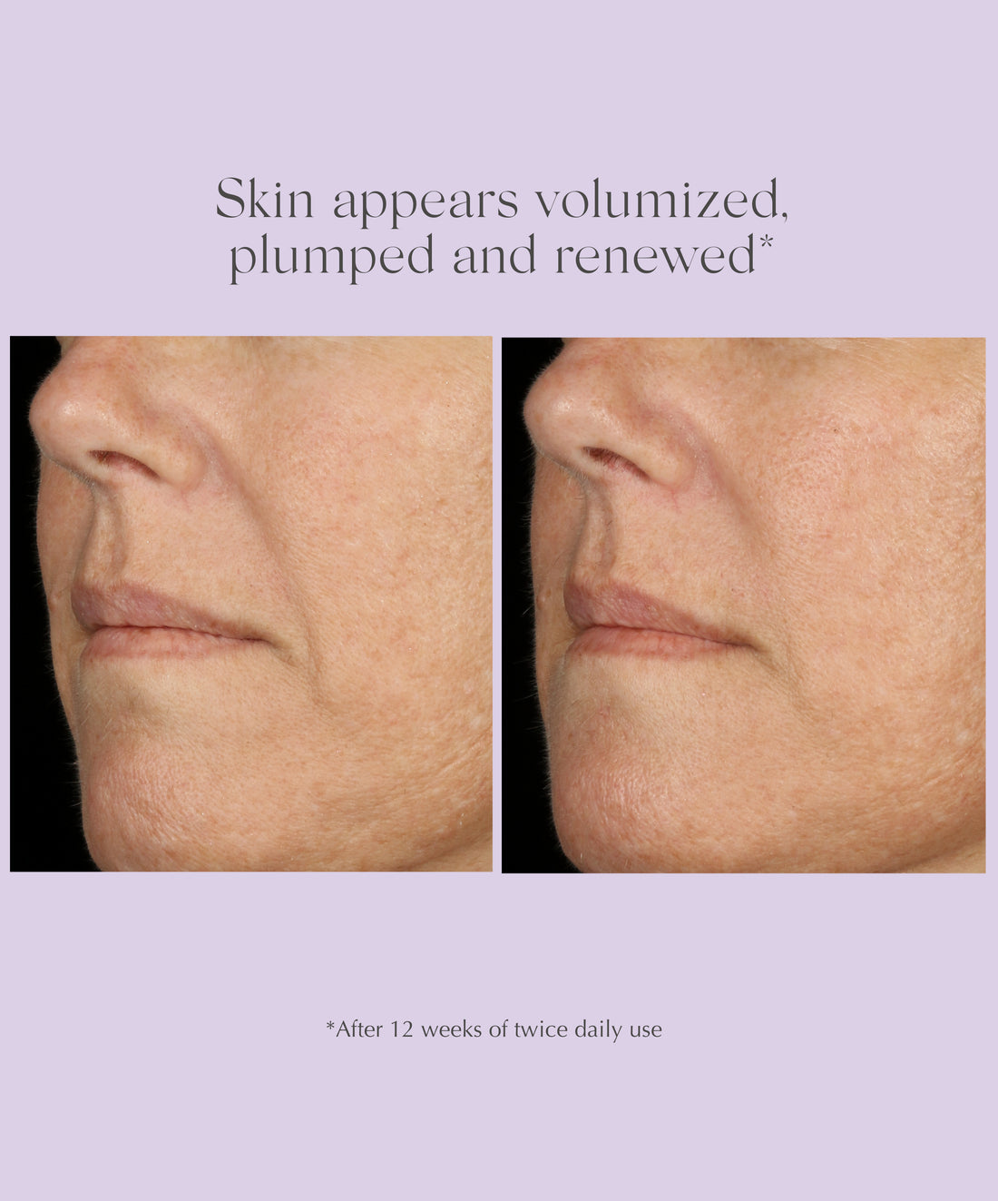 AGE REVERSE+ Total Correct Serum 30ML