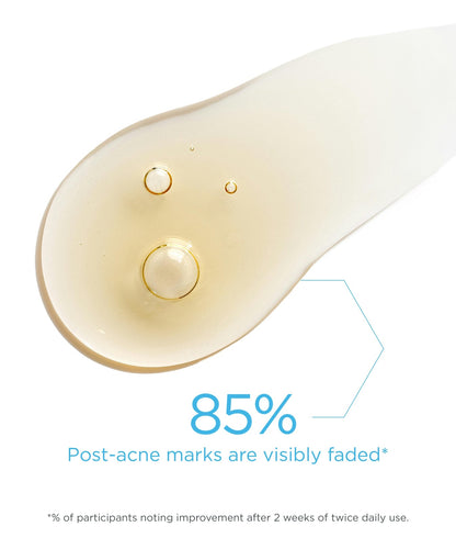 Clarify Post-Acne Mark Correcting Serum - 30ML