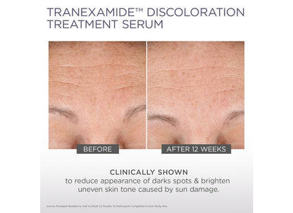 Micro-Peel TranEXamide Discoloration Treatment Serum 30ML