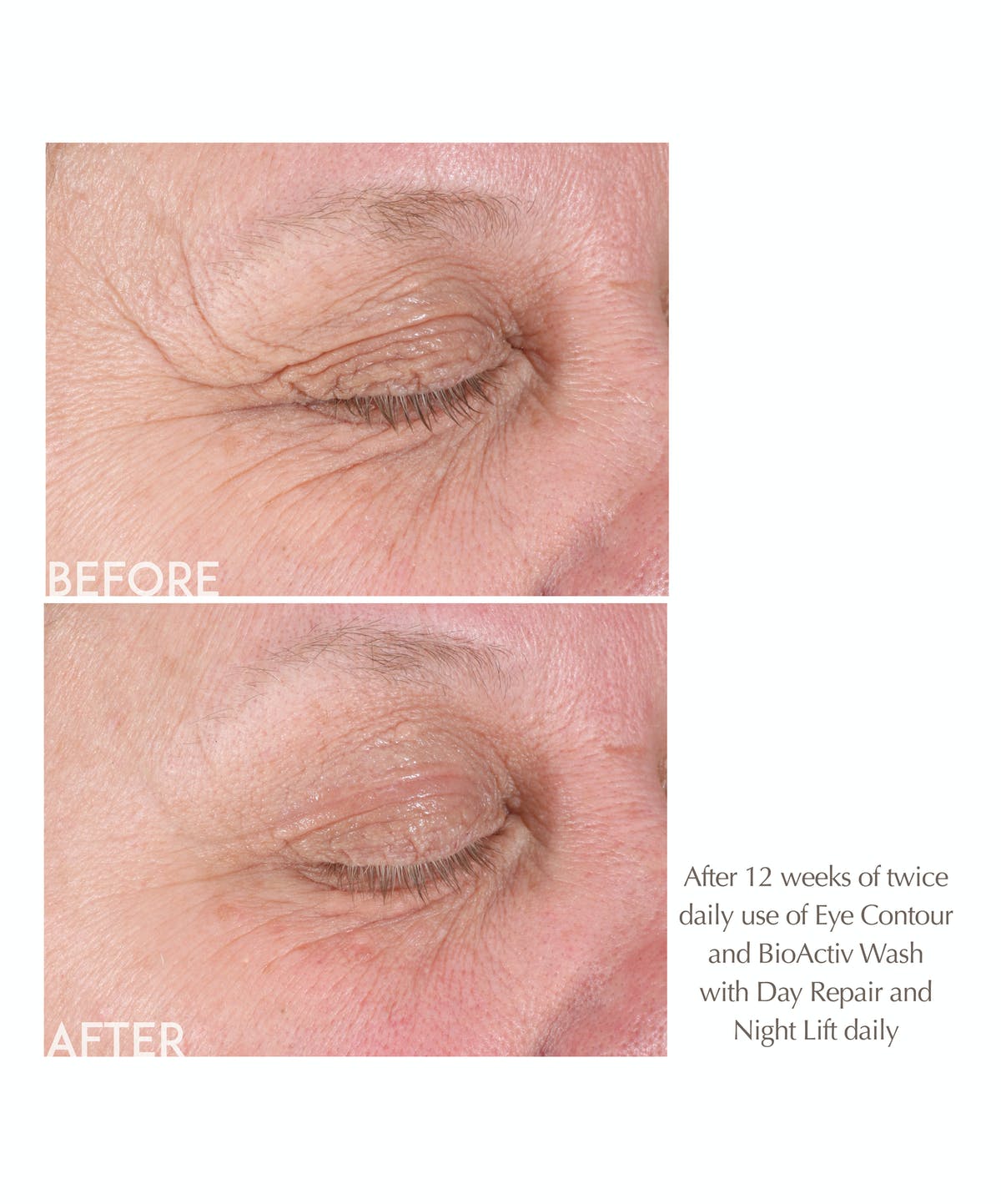 AGE REVERSE Eye Contour